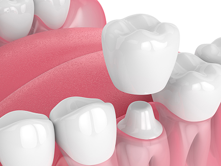 Advanced Dental Centers