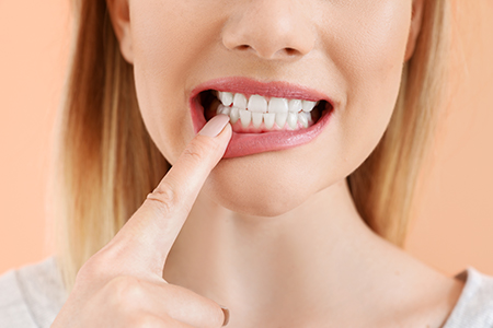Advanced Dental Centers
